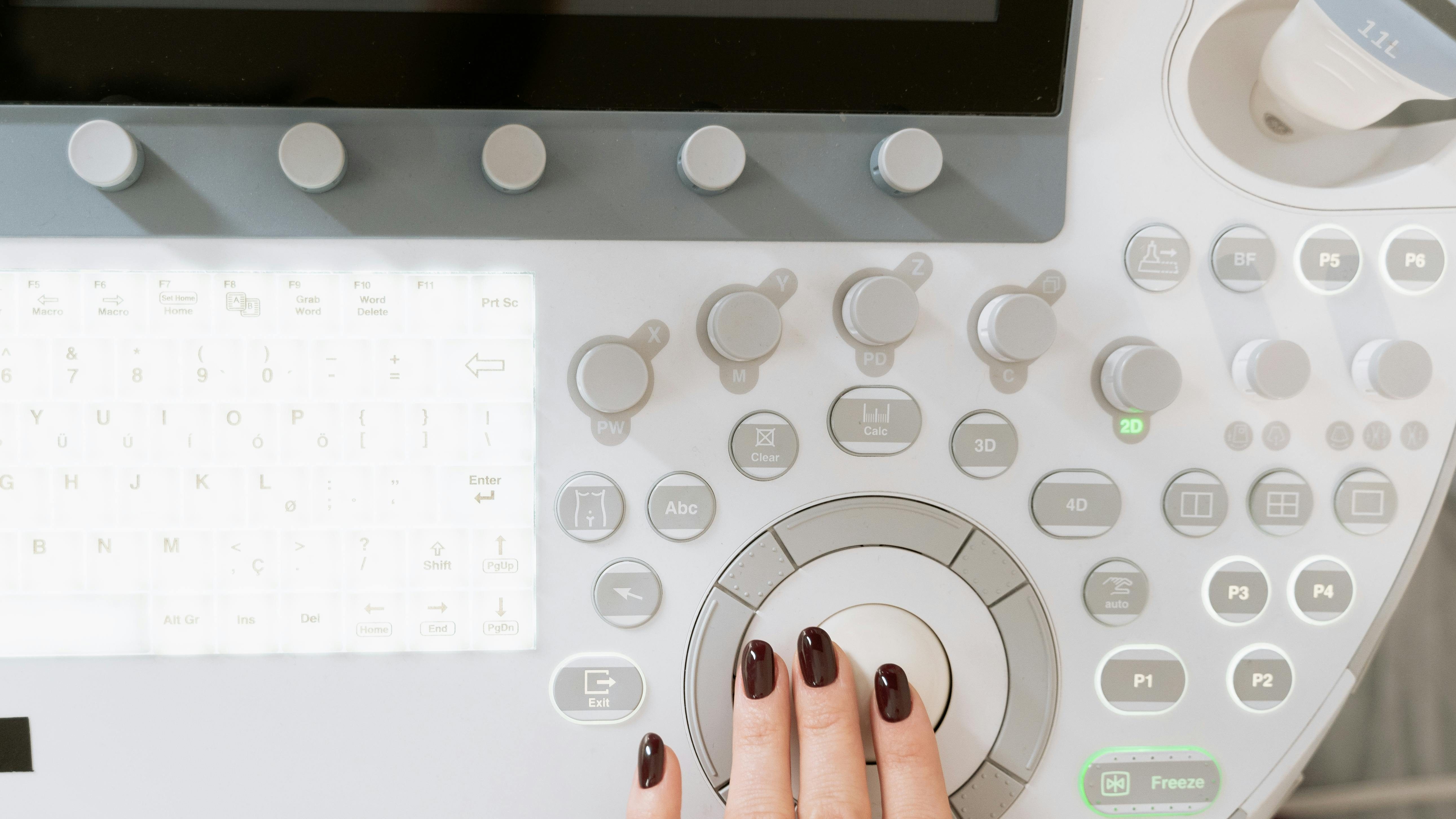 Ultrasound machine with a hand on the trackball.